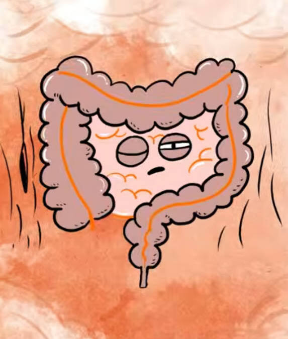 Tino o intestino